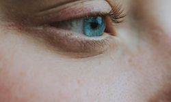 Göz seğirmesi neden olur? Göz seğirmesi tedavisi nedir?